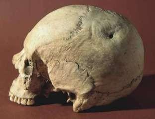 7 Catálogo de Cavidades de la Provincia de Alicante www.cuevasalicante.com ARQUEOLOGIA Cráneo de la Cova d'en Pardo Eneolítico (2.800-2.200 a.c.) Cova d'en Pardo (Planes de la Baronía) Cráneo perteneciente a un adulto joven (20-25 años) de sexo másculino.