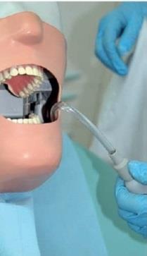 del diente que se va a tratar, de forma que no se aleje más de un centímetro de