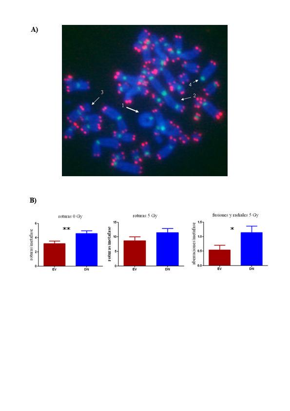 Resultados Figura 1. Análisis citogenético en células Ramos deficientes en pol µ. A) FISH telomérico, donde la señal verde procede de la sonda telomérica (FITC) y el DAPI tiñe de azul el cromosoma.