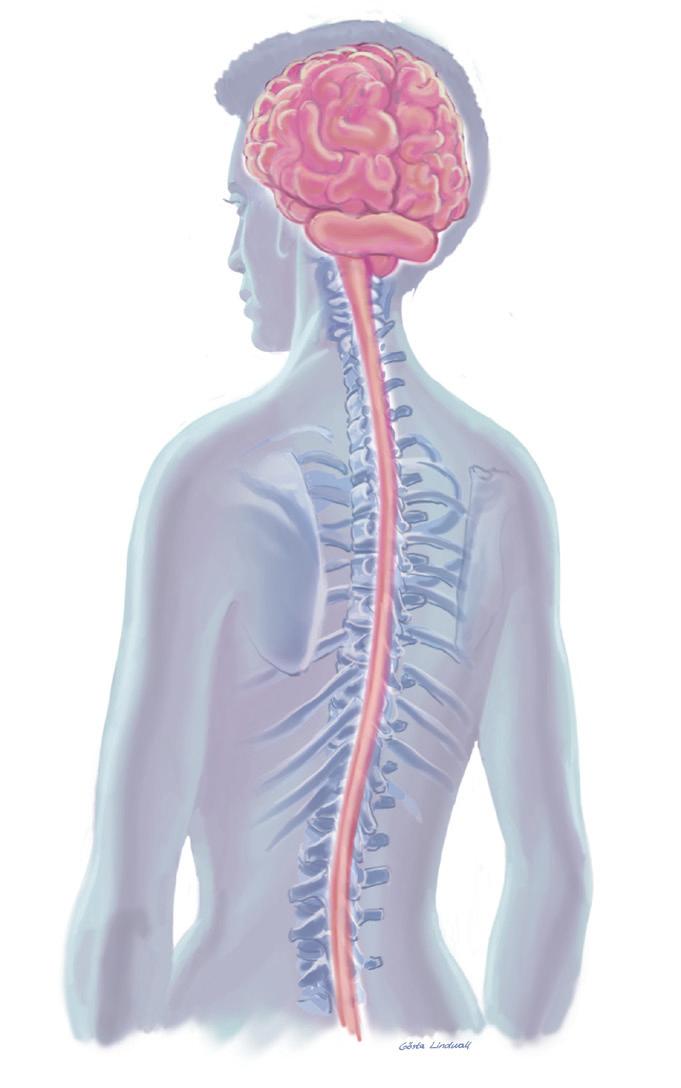 Esclerosis múltiple: una breve descripción En la esclerosis múltiple (EM), se produce una inflamación que dificulta el paso de las señales eléctricas entre las células nerviosas del sistema nervioso