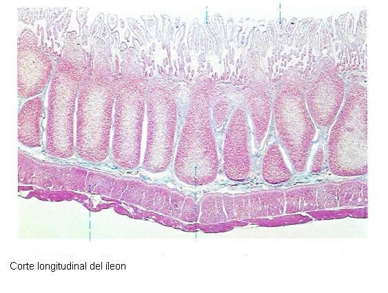 2/5 partes proximales es el yeyuno y el resto constituye el ileon, no hay características anatómicas que distingan uno del otro, ya que se hace de forma gradual a lo largo del intestino delgado.