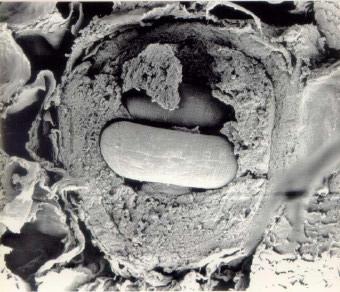 ME de larva de T. spiralis en quiste muscular Foto obtenida por el Dr. Raul Costamagna. La célula nodriza: Los cambios que la larva de Trichinella sp.