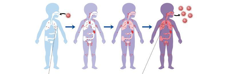 Virus sarampión: vía de entrada, diseminación y