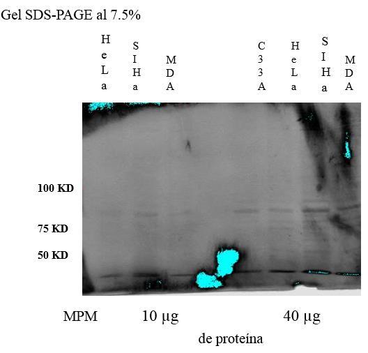 - Patrones de proteínas en SDS-PAGE 1D a dos concentraciones 10 y 40 µg de proteína.