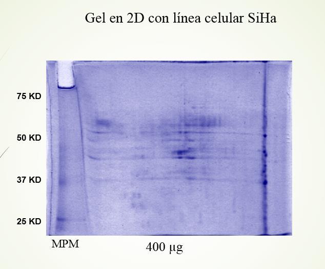 5, en una zona de peso molecular intermedio y b) gel SDS-PAGE cargado con la línea celular MDA (línea celular de glándula mamaria), teñidas con azul de Plata.