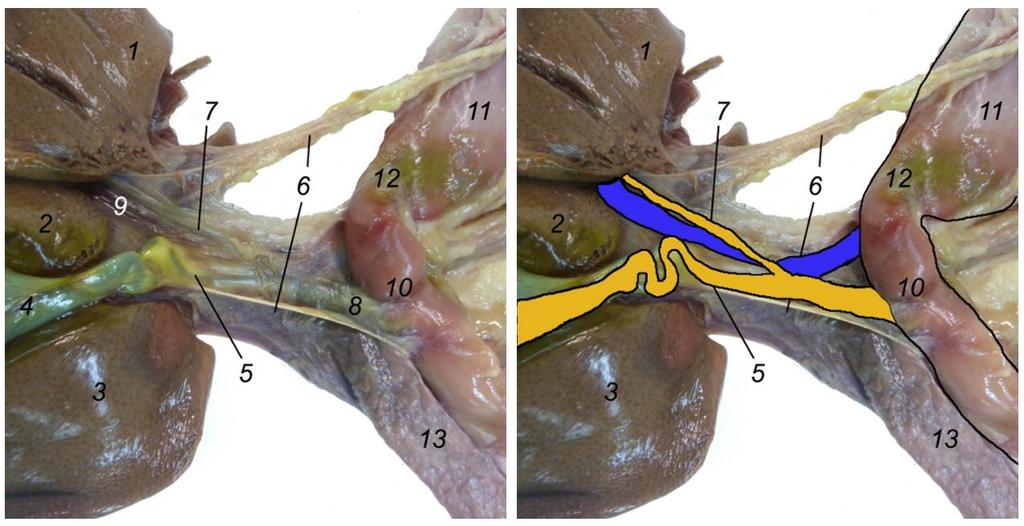 Figura 3. Entrada del conducto colédoco en el duodeno (gato). 1 Lóbulo izquierdo lateral del hígado. 2 Lóbulo cuadrado. 3 Lóbulo derecho lateral del hígado. 4 Vesícula biliar.