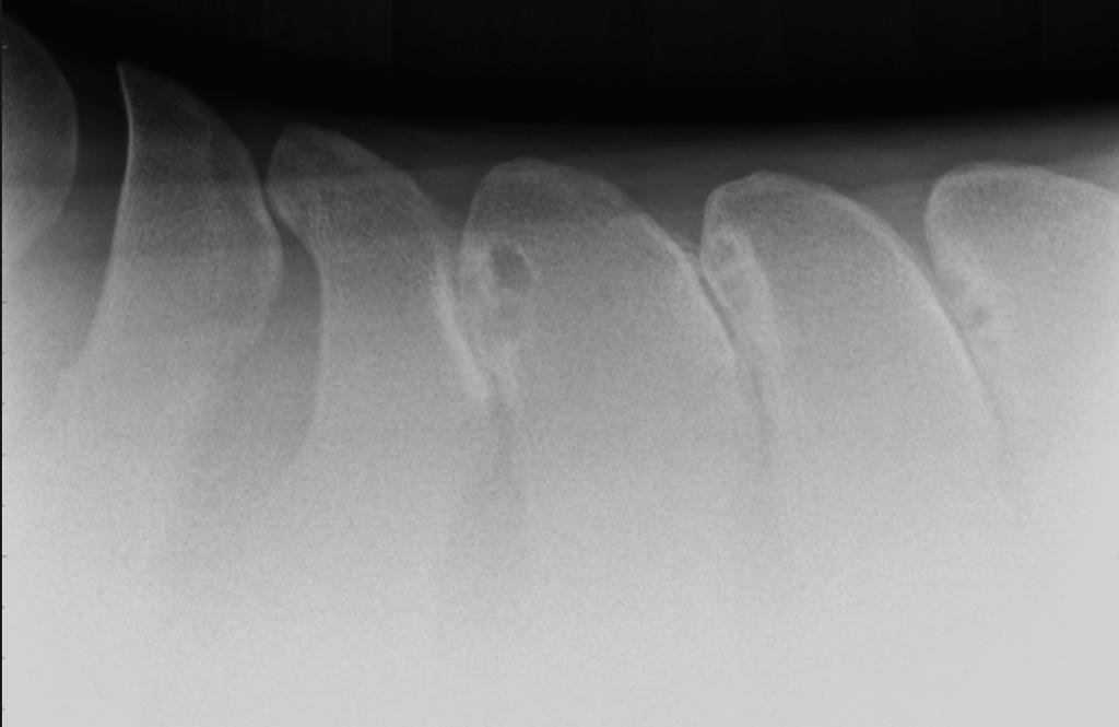 Blanca de Castilla, 5-1ºB Imagen 6: Radiografía laterolateral de vértebras torácicas con