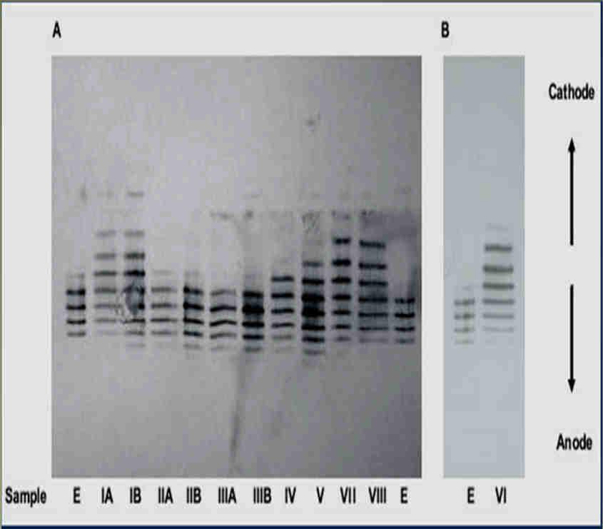 Heterogenicidadde Proteínas Terapéuticas: Análisis mediante cromatografía de diferentes Eritropoyetinas similares en América Latina (No son iguales).