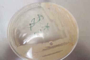 A B C Figura 6, 7 y 8: Cepas de B.subtilis. A, cepa silvestre; B, cepa con el plásmido pub110::sspe::vgb y C, cepa con el plásmido ptrp::vgb, en agar 2xYT y con el antibiótico correspondiente. 12.