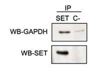 Funciones de GAPDH: Enzima glucolítico NAD + NADH + H + Gliceraldehido-3-P 1-3 bisfosfoglicerato HPO 4 2- Otras funciones: -reparación DNA -apoptosis -transcripción -transporte mrna Validar por WB su