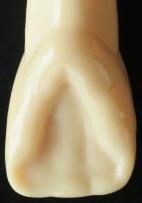 - Cresta marginal: es una cresta elevada que se encuentra en los bordes de las caras lingual/palatina de los dientes anteriores, y en los bordes mesial y distal de los dientes posteriores.