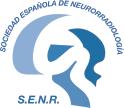 quimioterapia Àlex Rovira Unidad de Neurorradiología.