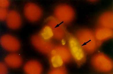 mitocondria y mediada por los receptores de muerte) Todas las vías convergen a un único sistema de proteasas efectoras (CASPASAS) Apoptosis Efecto de burbujas en la membrana Encogimiento de la célula