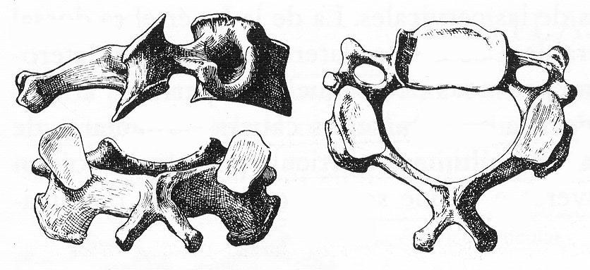 Vértebra cervical 2 2 1 3 4 5 Las vértebras son anillos óseos que se componen de tres partes: el cuerpo vertebral; (1)en la zona anterior y más voluminosa del anillo, en forma de segmento cilíndrico