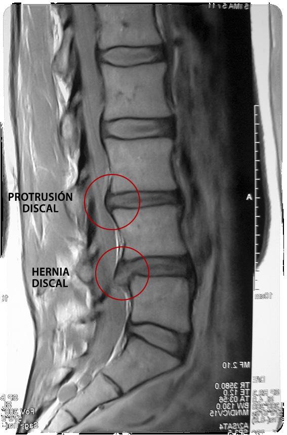 Fisiología y biomecánica lumbopélvicas Importancia de las curvaturas Curvatura normal y alteraciones de las curvaturas Articulaciones de la columna vertebral Bloqueos articulares Ligamentos