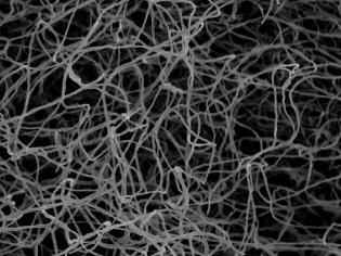 Micelio: masa de filamentos producto de la