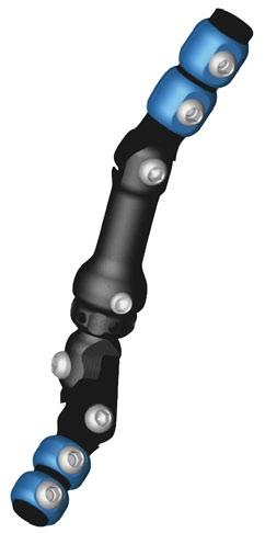 posibilidad de elegir el punto de inserción (rotación del perno y de las abrazaderas en el eje).