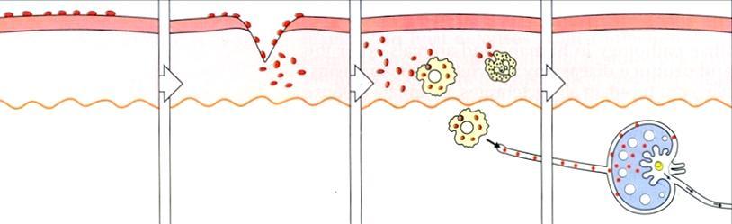 Inicio de la inmunidad adaptativa: Acumulación de líquido y células La inflamación dirige el tránsito de las células y moléculas de las defensas innatas desde el lugar del daño hacia los ganglios