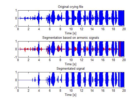 Finalmente, se utilizó un algoritmo de segmentación en el dominio de la frecuencia basado en el reconocimiento de patrones armónicos en la señal al ser procesada en intervalos de pequeñas ventanas.