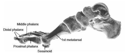 ANEXO 2: En esta radiografía, los dos huesos sesamoideos se pueden ver fácilmente sentados en la cabeza del