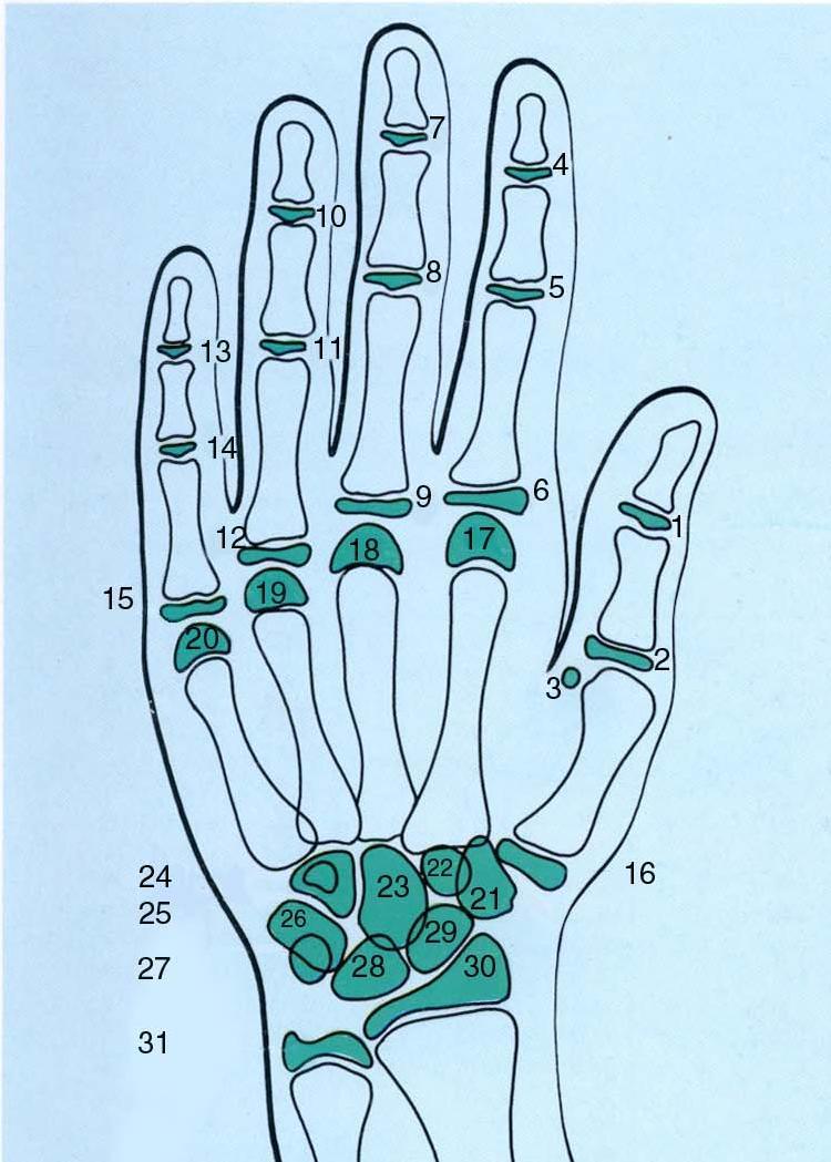 LA MANO En ella, se describirán los centros de o sificación mas usados en los dedos, falanges, metacarpo y carpo. Fig. 7,A -B Fig. 7-A. Esquema de la mano y muñeca. Tomado del Atlas de Rakosi, 1992.