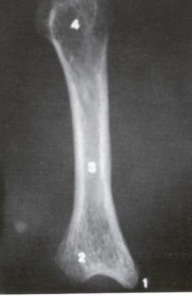 Hueso Metacarpiano Vista dorsal B. Imagen radiográfica C. Esquema 2 1 Fig 15,A-B-C. Hueso Metacarpiano.