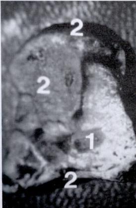 Representa los 8 huesos del carpo, Tomada de Villavicencio, 1996.