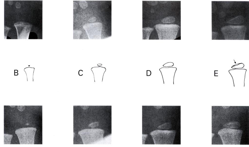 Fig.42 A.