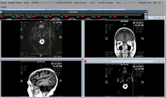 La gestión de peticiones y pruebas de radiología