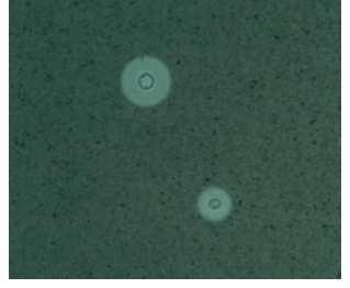 Fig: Crytococcus neoformans rodeados de un halo claro, la capsula. 4. La identificación de levaduras. 4.1 Criterios morfológicos.