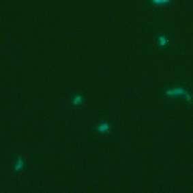 de los péptidos utilizados, observándose así el anticuerpo secundario unido a un fluorocromo.