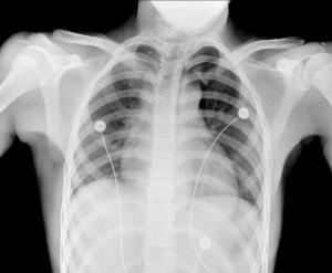 Rayos X Medicina: radiografías,