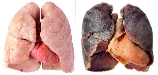 CÁNCER PULMONAR Es el cáncer que comienza en los pulmones.