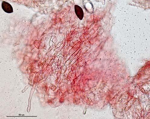 5. Pelos alrededor del ostiolo largos, rectos, rígidos, hialinos y no septados, de alrededor de 50 µm de largo.