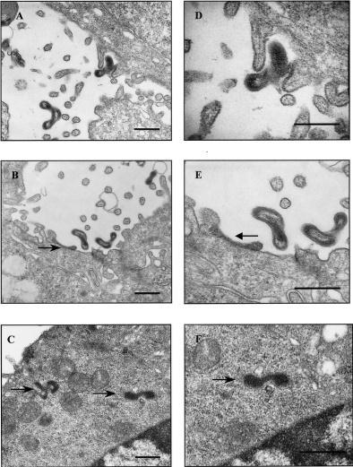 Fisiopatología Invasión Piel erosionada Mucosas Uniones intercelulares