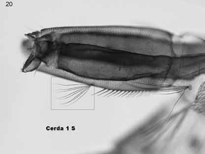 Keys for identification of adult females and fourth stage larvae in English and Spanish (Diptera, Culicidae). Mosquito Systematics 17(3): 153-253 Diallo, M., P. Nabeth, K. B. A., A. A. Sall, Y. B. A M.
