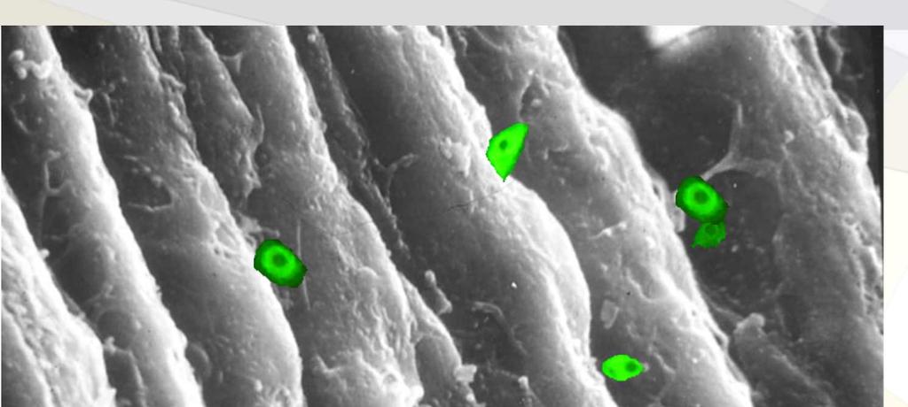 Siembra de condrocitos autólogos (microscopía