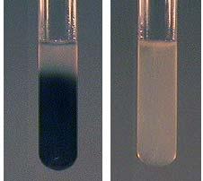 Medio SIM (Sulfhídrico Indol Movilidad) Medio SIM (medio semisólido) Sustratos: Tiosulfato o grupos SH de la cisteína y triptófano. Enzimas: Tiosulfato reductasa, cisteína desulfurilasa y tiptofanasa.