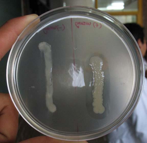 Agar Gelatina OBJ. Determinar si el microorganismo es capaz de degradar la gelatina.