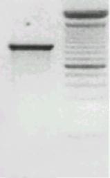 PCR DIAGNOSTICA Nos dice si hay ARN VIRAL SI ó