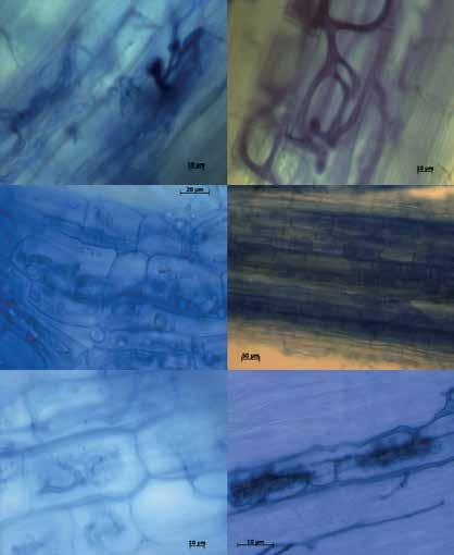 a b c d e f A A A Figure 5. Light microscope micrographs of arbuscular mycorrhiza: a c. Different hyphal structures in cortical cells; d f. arbuscules in cortical cells. A = Arbuscules.