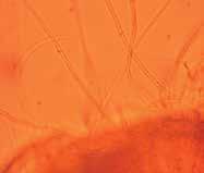 a b Hyphal mantle Extraradical hyphae c Ectomycorrhizas The observation