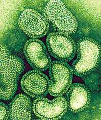 LO QUE TODOS SIEMPRE HAN QUERIDO SABER SOBRE LA GRIPE PORCINA Nº1 L a influenza porcina, comúnmente llamada gripe porcina, es una patología de origen viral mutante que viene del siglo pasado,