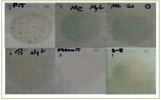 Fotografía D: Identificación de Escherichia coli en siembra de queso dilución 10^-2. Fotografía E: Identificación de Enterobacterias en siembra de queso.