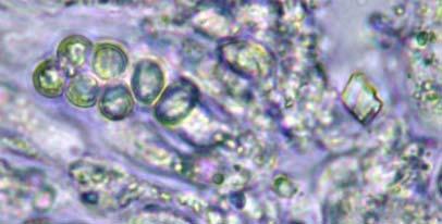 Tamaño y forma de las esporas Esporas < 15 µm Esporas entre
