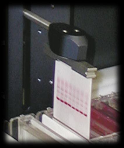 Medios de Soporte Acetato de Celulosa Se usa en el análisis de fluidos biológicos (proteínas séricas, proteínas urinarias, hemoglobinas). Tiempo de análisis corto.