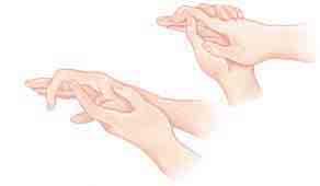 Deslizamiento del tendón Ejercicios de bloqueo 1. Comience con los dedos extendidos. 1. Sostenga la mano lesionada con su Luego, ciérrelos para formar un puño mano buena (no lesionada).
