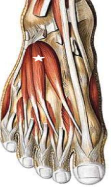 LOS MÚSCULOS DEL PIE Hay dos tipos de músculos que actúan sobre el pie: 1.