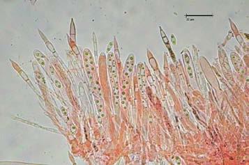 2: Ionomidotis irregularis: Esporas (x1000 agua).