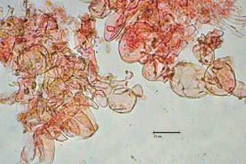 1988) Ionomidotis irregularis es una especie que se considera rara en Europa y se distingue fácilmente de las otras especies de este género por tener grandes apotecios (50-60mm) albeados oscuros, y